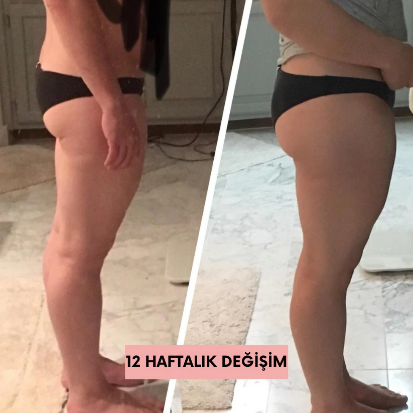 DoktorMedikal Ems Kalça Şekillendirici ( Karın - Kol İçin Uygun )