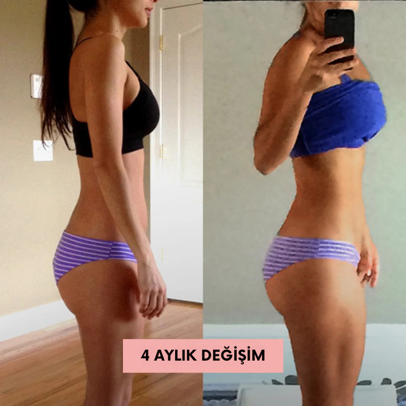 DoktorMedikal Ems Kalça Şekillendirici ( Karın - Kol İçin Uygun )