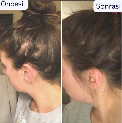 Doktor Medikal Saç Derisi Masaj aleti