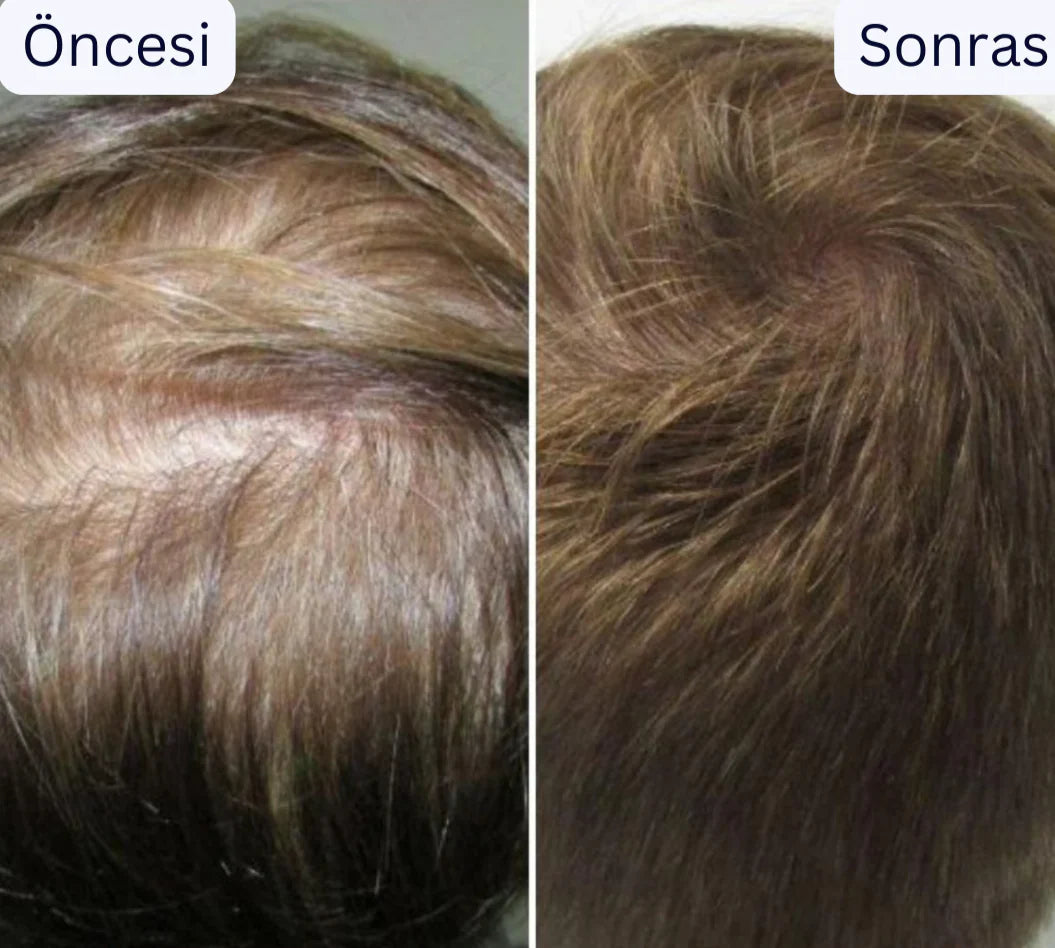 Doktor Medikal Saç Derisi Masaj aleti