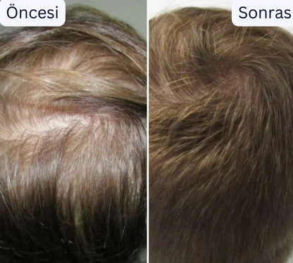 Doktor Medikal Saç Derisi Masaj aleti